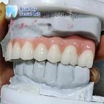 Artificial Dental Implant Case Multiple Sterilization Implant Cases