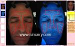 3D facial magic mirror skin analyzer with professional camera