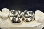 Wax Casting Dental Repair Full Metal Crown For Abrasion Resistant Oral
