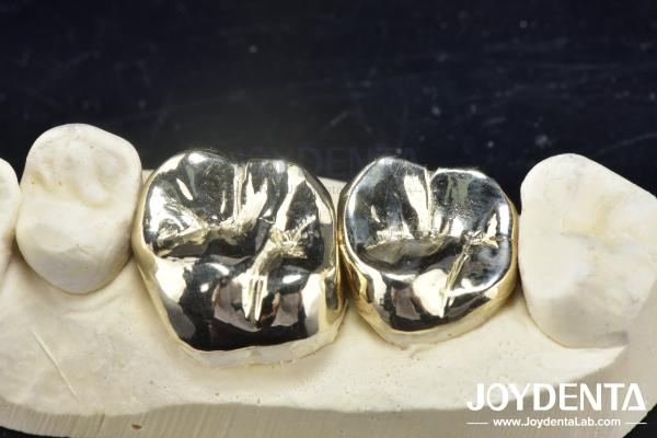 Wax Casting Dental Repair Full Metal Crown For Abrasion Resistant Oral