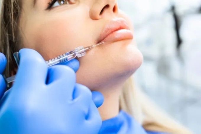 Dermal Lip Fillers JUR KISS Red Lips Injection Filler Customization Hyaluronic Acid Lip Augmentation