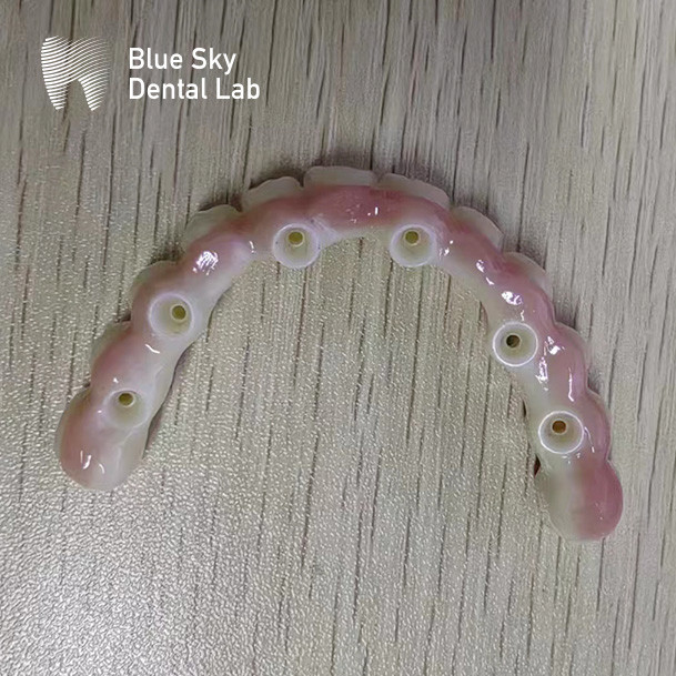 Blue Sky Nature Dental Implant Case Multiple Choices Implant System
