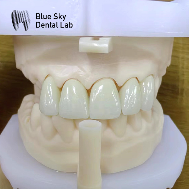 Layered Zirconia Crowns Pink Porcelain Zirconia Dental Crown For Aesthetic Restorations