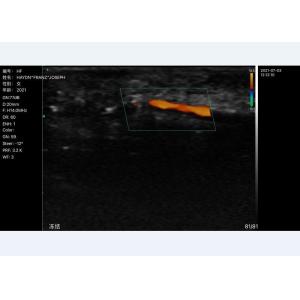 305mm Portable Handheld Ultrasound Scanner Probe Convex+Linear+Cardiac