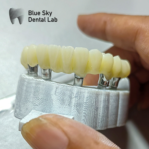 Steam Sterilization Single Implant Crown Smooth Surface Dental Implant Crown