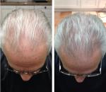 Hair growth oil