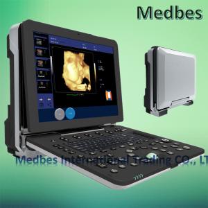 China 4D Color Digital Portable Ultrasound Scanner Portable Echocardiography Machine 2D Echo factory