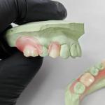 High Precision Thermoplastic Resin , Flexible Partial Denture Base Resin