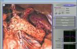 Quantum Magnetic Resonance 3d Nls Health Analyzer , Win XP Win 7