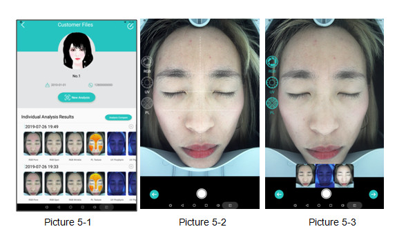 High Definition Facial Analysis 3D Digital Observ Machine with RGB UV