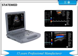 China 15 Inch Display Laptop Color Doppler Ultrasound Machine Probe Automatic Identification factory