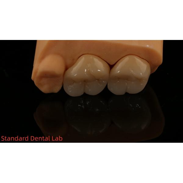 Solid Dental Lab Crowns 3D Pro High Translucency Full Zirconia Crowns with 5-Year Guarantee