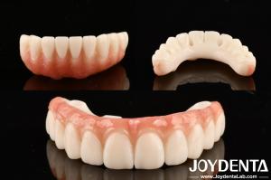 China High Transparency Dental PMMA M75 For Aesthetic And Scratch Resistant Restorations factory