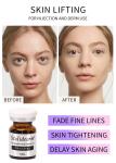 Stalideram Anti Aging Skin Lifting Injection Serum Injection Head Skin Care PRP