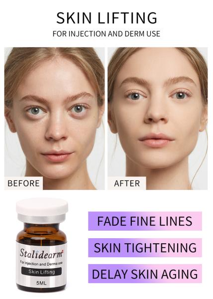 Stalideram Anti Aging Skin Lifting Injection Serum Injection Head Skin Care PRP