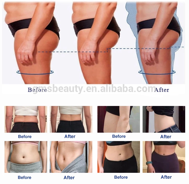 Before and after (3)