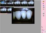 17 Inch Touch Screen Dental Chair Unit Endoscope System with Wifi