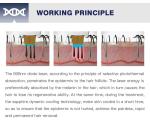 Guangzhou DPL Beauty Machine Factory Supply 60 million times shot Diode Laser