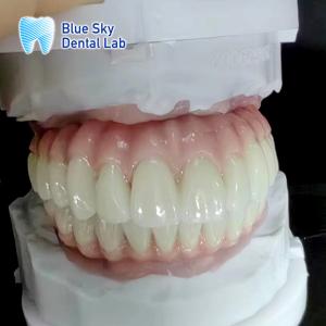 China Regular Dental Implant Case Nature And Durability For Medical Equipment factory