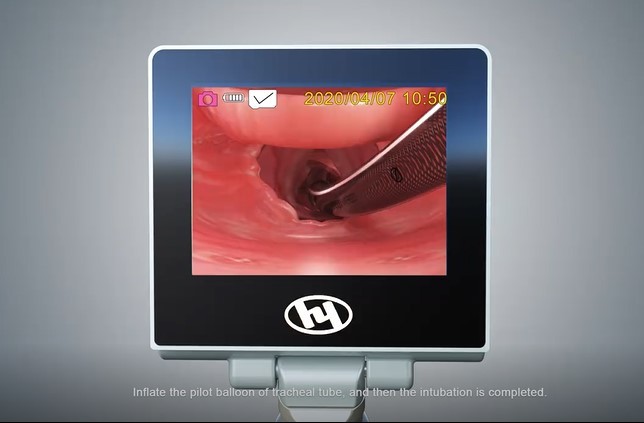 Remarkable Durable Handheld Direct Laryngoscope for Difficult Intubation