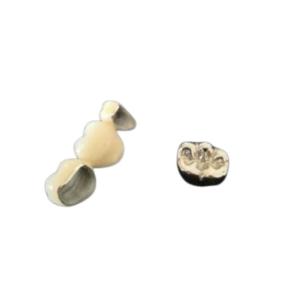 China OEM Polishing Porcelain Dental Crown High Biological Intermiscibility factory