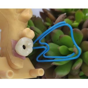 Single Tooth Trushine OSSETEM Dental Implants Fixture Level