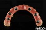 Comfortable Wear Titanium Malong Hybrid Bridge Dental Adjustable Design Light