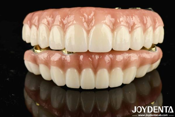 High Durability Ti-Bar Zirconia Hybrid Bridge The Ultimate Choice for Achieving