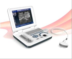 China Diagnostic Laptop Ultrasound Machine Digital Ultrasound Scanner Durable factory
