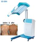 Phototherapy Treatment UVB Light Therapy Machine , UVB Narrow Band Light Therapy