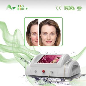 China RBS Portable 150W Spider Vein Removal machine for Vascular Removal factory