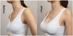 Injectable Hyaluronic Acid Ha Filler For Lips Facial Wrinkle Breast Enlargement