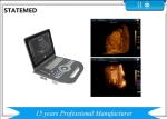 36.9×38×79 CM Laptop Ultrasound Scanner / 6.5 Kg Portable Baby Ultrasound