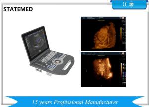 China 36.9×38×79 CM Laptop Ultrasound Scanner / 6.5 Kg Portable Baby Ultrasound Machine factory