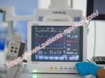 Mindray BeneView T5 Patient Monitor 800×600 Pixels