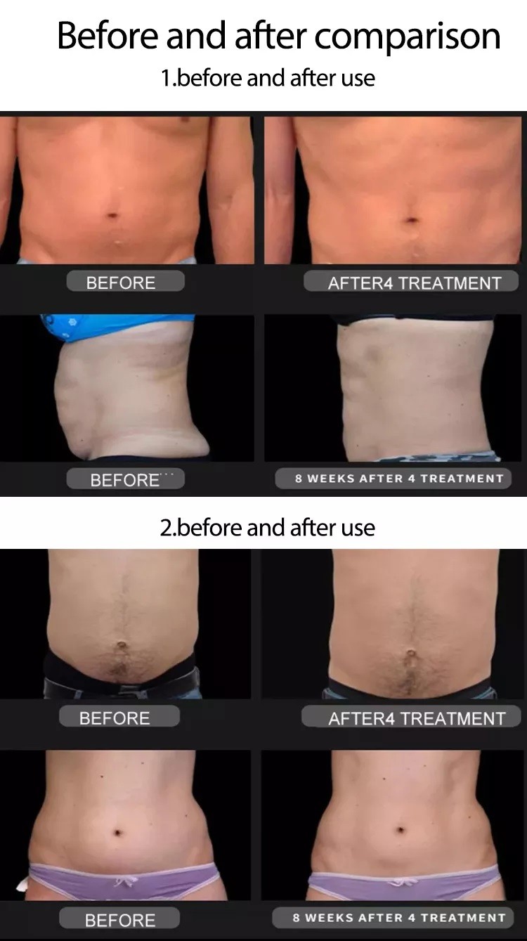 Fitness Buttocks Ems Body Sculpting Machine Fda Approved