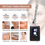 Tattoo Removal Q Switched ND YAG Laser Machine