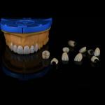 Dentists Cad Cam PFM Crown Ceramic Material Metal Foundation