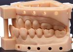 Dental 405nm UV Photopolymer Resin Strong Resistance To Falling And Beating