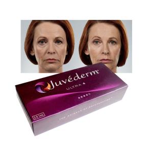 China Ultra3 Juvederm Hyaluronic Acid Dermal Filler 20mg/Ml Lip Enhancement Fillers factory