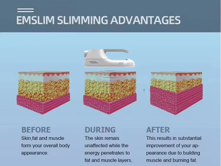 Fat Burning Rf Ems Body Shaper Four Way Four Control Device HI-EMT Machine