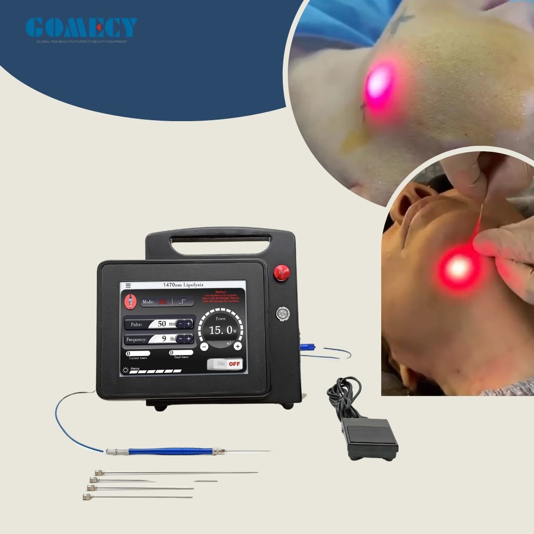 Endolifting Endolaser Diodo 980 Nm Massage Slimming Body Shaping Liposuction Machine 1470Nm Laser