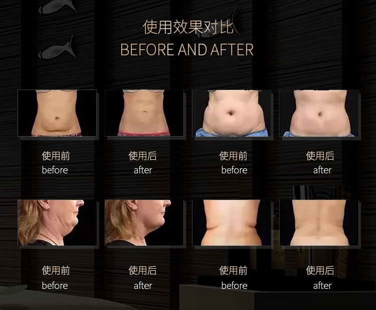 Portable Weight Loss Radiofrquence 40K Cavitation Machine 6 In 1 Fat Removal Ultrasonic Cavitation Body Slimming Machine