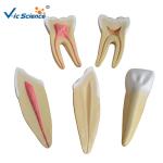 19x16x11cm Dental Study Models