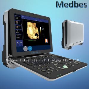 China 4D Portable Color Ultrasound System Scanner Color Doppler Ultrasound Scanner is Based on Windows factory