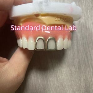 ISO Full Acrylic Dentures With Yellow Gold Teeth Open Face