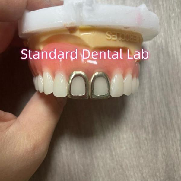 China ISO Full Acrylic Dentures With Yellow Gold Teeth Open Face factory