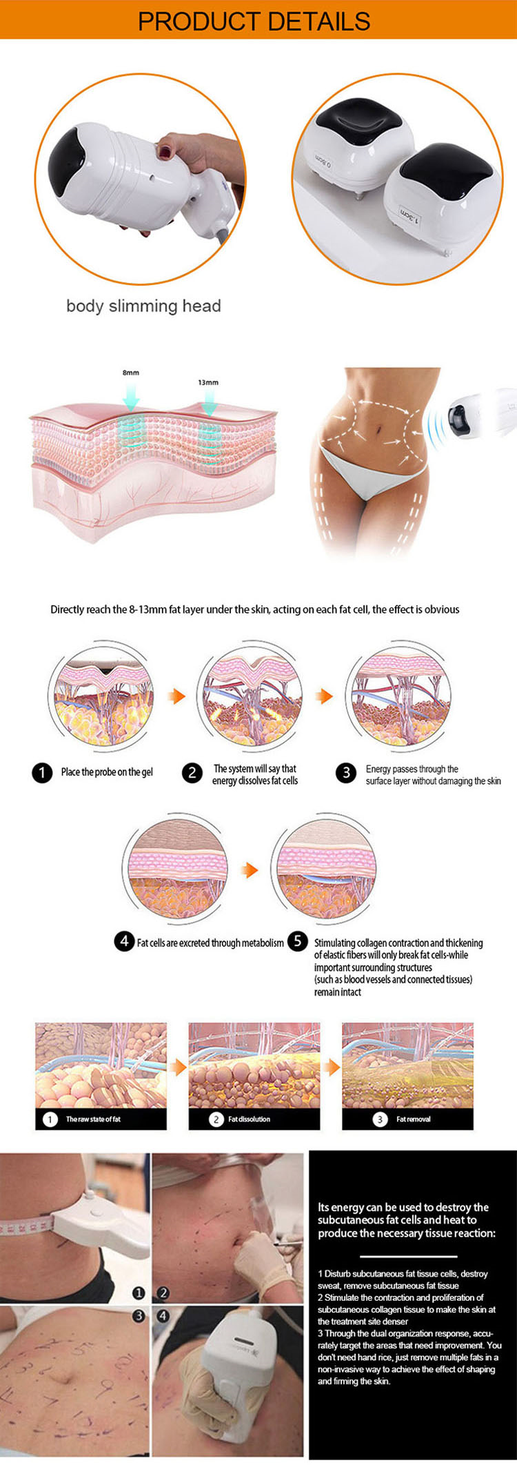 Wrinkle Removal Micro Needle RF And HIFU 2 In 1 Beauty Machine For Face And Body