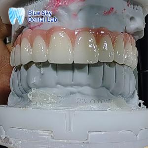 China Artificial Dental Implant Case Multiple Sterilization Implant Cases factory