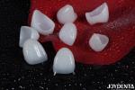 CAD/CAM Compatible Zirconia Dental Crowns Precision Manufacturing For Tailored